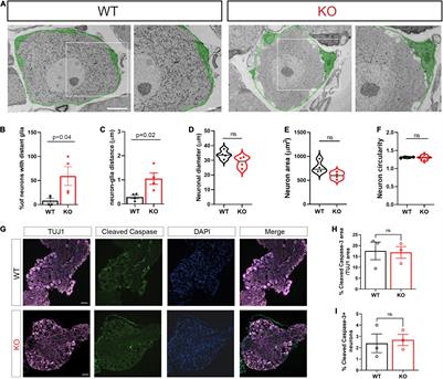 Disrupted Association of Sensory Neurons With Enveloping Satellite Glial Cells in Fragile X Mouse Model